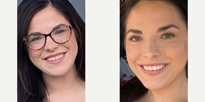 Woman treated with Vivace - The doctor and PA carefully created a custom treatment plan for this patient. She just finished Accutane with us and we are now correcting scars with Vivac and skin pen. Skin health has totally changed her appearance!