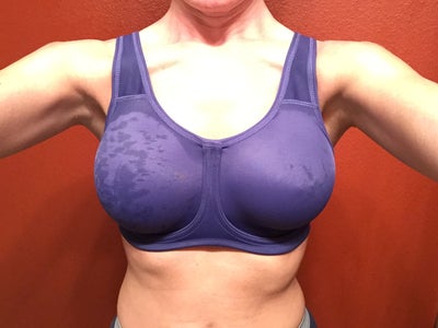 39 YR Old 34B Mentor Smooth Round 375cc High Profile Silicone 