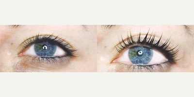 35-44 year old woman treated with Lash Lift - 35-44 year old woman treated with Lash Lift