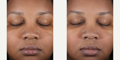 Skinbetter Science - Sunbetter Sheer SPF 56 Sunscreen Stick.Photo provided courtesy of Skinbetter Science.