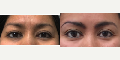 35-44 year old woman treated with Permanent Makeup - MicroBlading Before and After pictures by Dr. Deborah Sillins of Rejuvene Plastic Surgery in Northern Kentucky and Cincinnati.