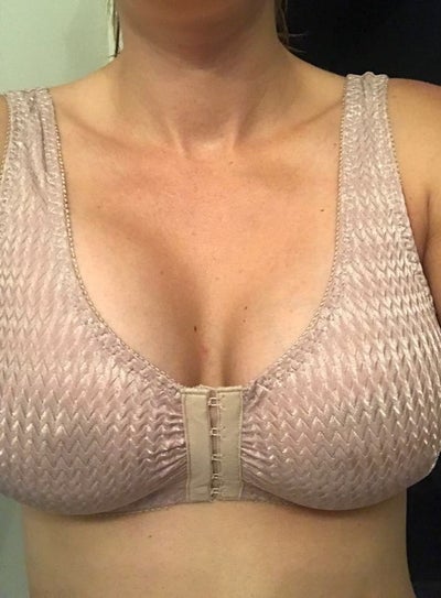 Fit 29 Yr Old Mom with Deflated 32D Looking for my Boobs Back! 