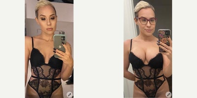 25-34 year old woman treated with Breast Implants, Breast Augmentation - I love getting pictures from patients to see how they are looking and feeling after surgery!What gets lost in the hospital gowns and the standardized before/after shots is the fact that we do what we do to help people feel their best, happiest and most comfortable in their own skin each and every day!This patient is only 1 month out from surgery and feeling great so happy to see this stunning transformation through her eyes in her world!!!