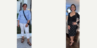 35-44 year old woman treated with Endoscopic Sleeve Gastroplasty - She lost 31 LBS in 3 months after her Endoscopic Sleeve Gastroplasty.