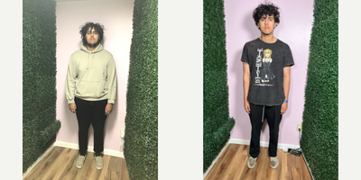 17 or under year old man treated with Orbera Gastric Balloon - he lost 73 LBS in 6 months after his Orbera Balloon weight loss procedure.