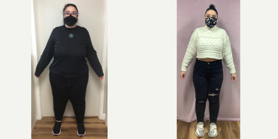 25-34 year old woman treated with Endoscopic Sleeve Gastroplasty - The patient had her Endoscopic Sleeve Gastroplasty procedure done by Dr. Batash. She lost 97 Lbs over one year and feels great.