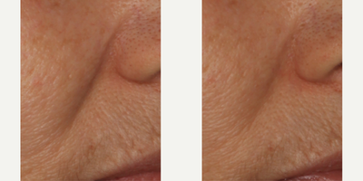 Skinbetter Science - InterFuse Intensive Treatment Lines.Photo provided courtesy of Skinbetter Science.