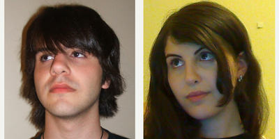 18-24 year old woman treated with Facial Feminization Surgery - Individual results may vary.