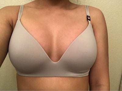 A, C) This 34-year-old woman presented for breast augmentation. (B, D)