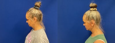 before and after image