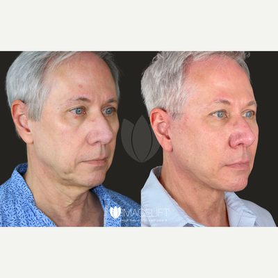 before and after image