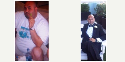 45-54 year old man treated with Lap Band - Pre-op weight: 356 lbsTotal weight loss: 107 lbs