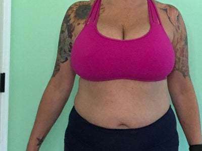 Amazing I Have Recommended Rowe Plastic Surgery To Everyone I