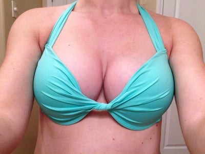 BEST Boob Job Ever - Painless 34A to 34D - Review - RealSelf