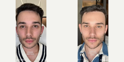 Man treated with Facial - Man treated with Facial