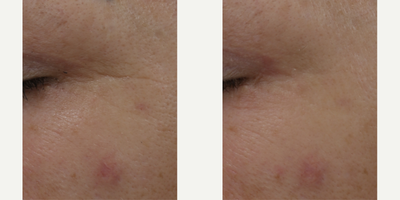 Skinbetter Science - AlphaRet Overnight Cream.Photo provided courtesy of Skinbetter Science.
