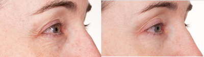 JeNu - 
	Photos courtesy of&nbsp;The Beauty Company
