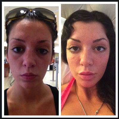 vitamin b12 injections inphiladelphia B12 Shots Near Me