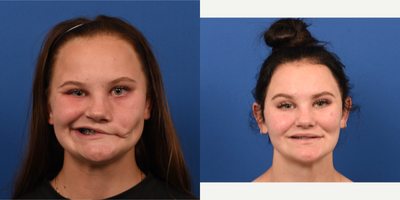 Facial Reconstructive Surgery - Facial Reconstructive Surgery