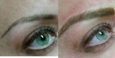 25-34 year old woman treated with Permanent Makeup - Eyebrow procedure using new microstroking technique (other names: microblading, eyebrow feathering, eyebrow embroidery). This technique reflects the most natural strokes possible.