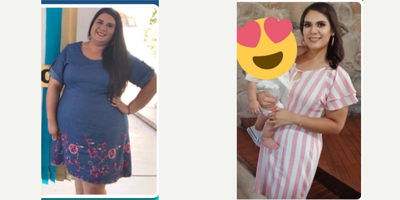 28 year old woman treated with Gastric Balloon - she lost 59 pounds in 6 months