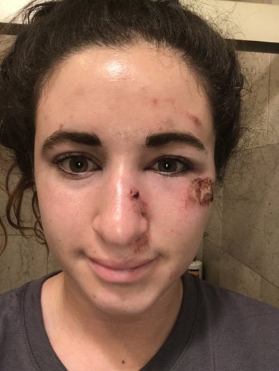 100 Would Recommend Dr Konka Review Realself Anita konka has a medical practice at 3400 spruce street, philadelphia pa, and has over 8 years of experience in the field of. 100 would recommend dr konka review