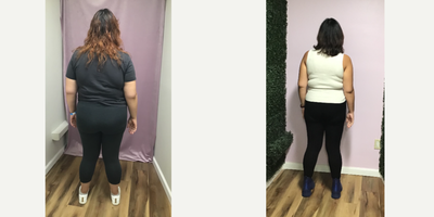 45-54 year old woman treated with Endoscopic Sleeve Gastroplasty - She lost 37 Lbs in 4 months after her Endoscopic Sleeve Gastroplasty procedure.