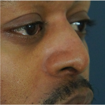 Carolina Facial Plastics Charlotte Charlotte North Carolina Realself