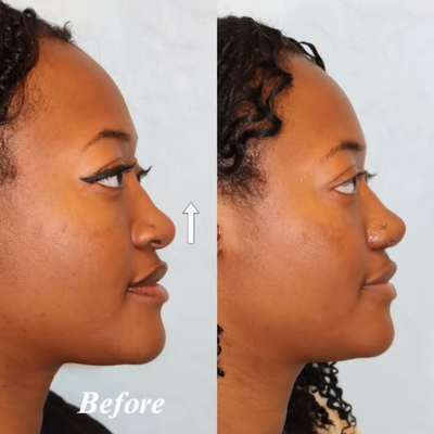 before and after image
