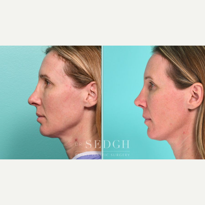 before and after image