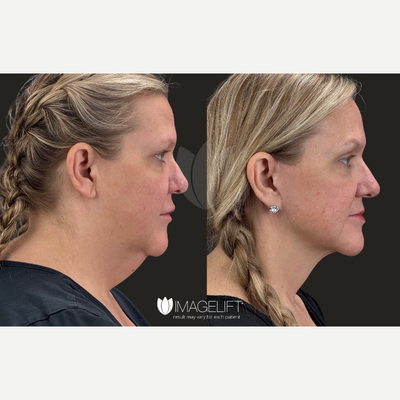 before and after image