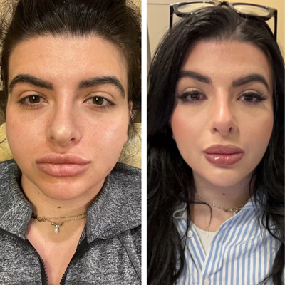 before and after image