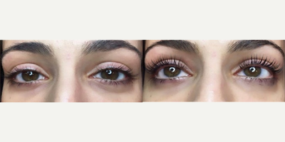 Woman treated with Yumi Lash Lift - Woman treated with Yumi Lash Lift