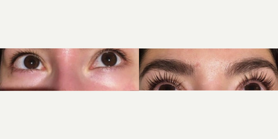 Woman treated with Yumi Lash Lift - Woman treated with Yumi Lash Lift