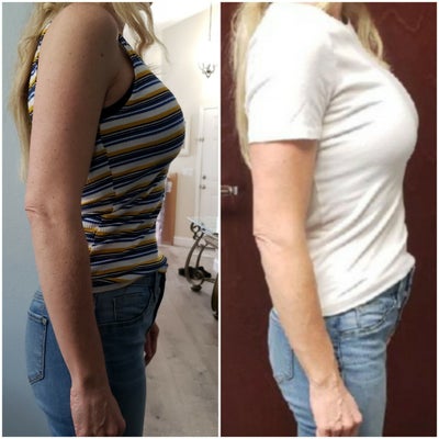 5ft 11in 160lbs. 34b to 34D!Mom of 2. - Review - RealSelf