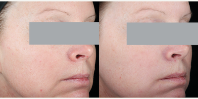 SkinCeuticals, H.A. Intensifier - H.A. Intensifier. Photo provided courtesy of SkinCeuticals