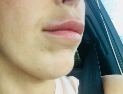 Fantastic Work She Saved Me Ann Jayaram Md Review Realself She completed an ophthalmology residency in all types of eye care and surgeries including comprehensive eye exams, cataract surgery, glaucoma procedures, and laser treatments. ann jayaram md