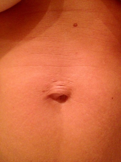 tummy tuck cost