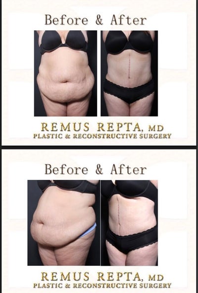 Amazing Doesn't Begin to Describe Dr. Repta - Review - RealSelf