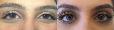 Latisse - Eyelash Growth - Eyelash growth after 16 weeks.