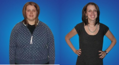 25-34 year old woman treated with Laparoscopic Gastric Bypass - 28 year old young lady with starting BMI 48 underwent a successful gastric bypass operation, after 11 months she managed to lose 120 lbs and she is now 8 years post operation and she still has kept the weight off.  Congratulations to people who make commitments and are willing to make the sacrifices that makes them come true.