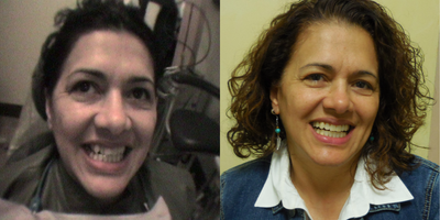 55-64 year old woman treated with Clear Braces - Andrea came to Steinway Family Dental Center wanting to improve her smile.&nbsp;