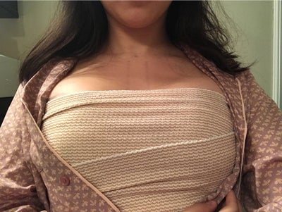 Micromastia: 5 Common Complaints Women Have About Disproportionately Small  Breasts - Bellevue & Kirkland, WA Plastic Surgeon