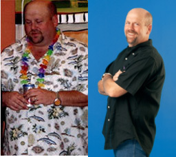 Male Gastric Bypass Patient Lost 124 lbs - 
	This male patient lost 124 pounds in the first year following his gastric bypass procedure
