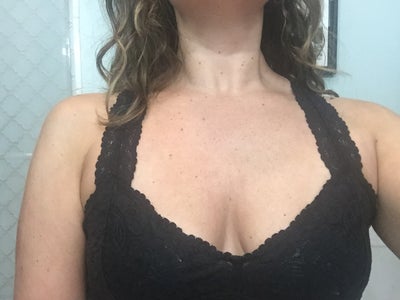 REVIEW] Reducing Armpit Fat / Bra Bulge with Mini Coolsculpt at Chelsea  Clinic – Esther K