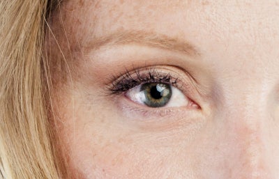 Eyelid Surgery