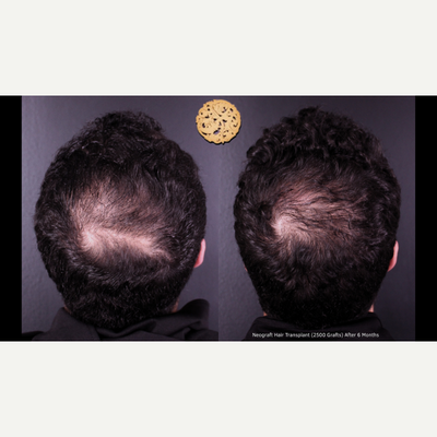 before and after image