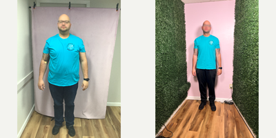35-44 year old man treated with Endoscopic Sleeve Gastroplasty - She lost 81 LBS in 1 year after his Endoscopic Sleeve Gastroplasty Suture Sculpt weight loss procedure.