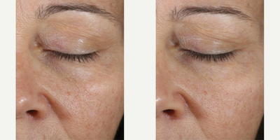 Skinbetter Science - Instant Effect Gel Eye.Photo provided courtesy of Skinbetter Science.