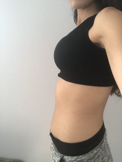 From itty bitty to 450CC ! 34DD post op! - Review - RealSelf